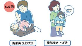 小児救命救急